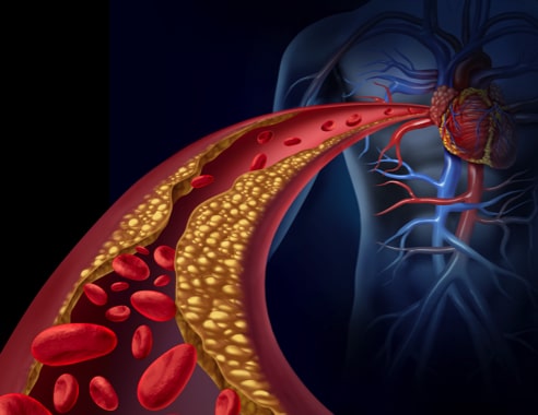 Können natürliche Aminosäuren bei Cholesterin helfen?
