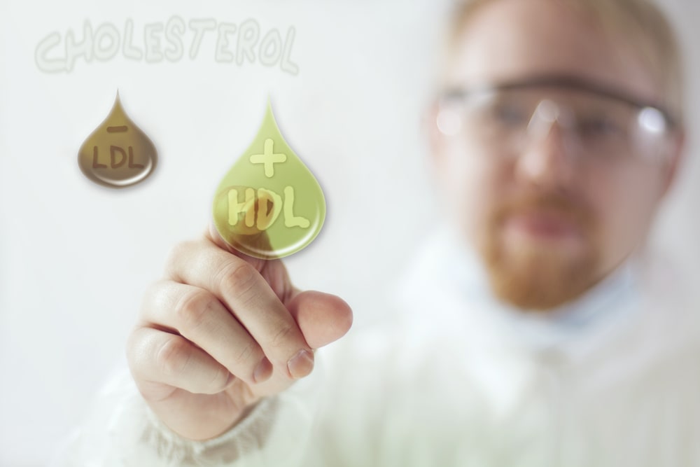 Cholesterinwerte untersuchen